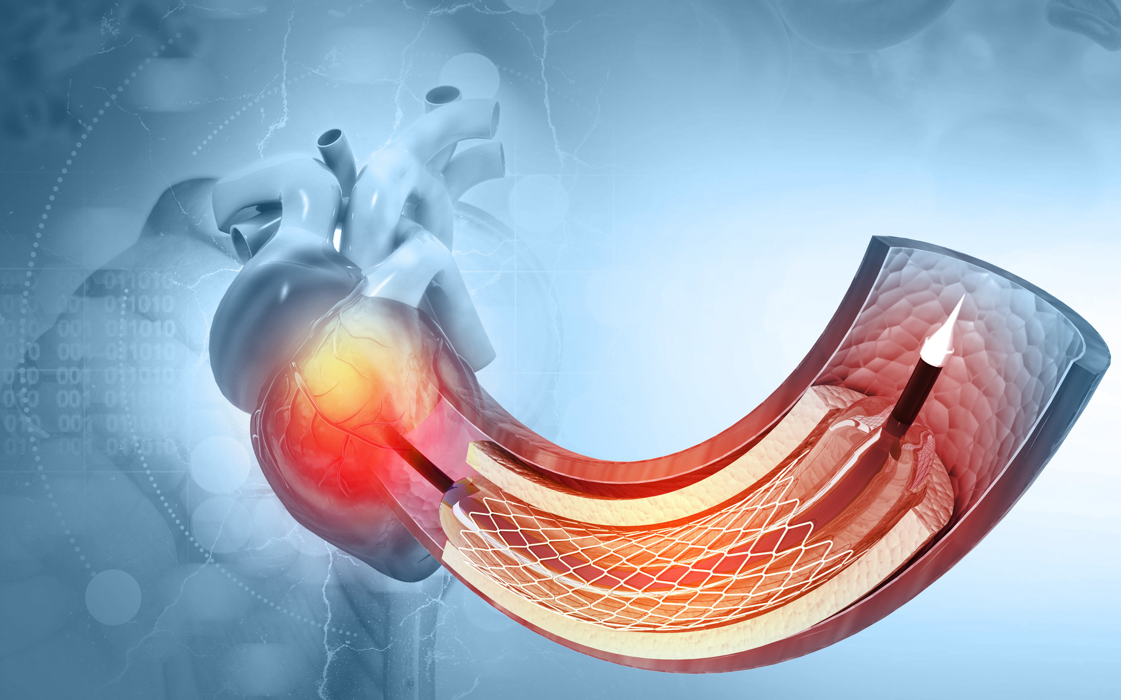 Ангиография не является лечением, а диагностическим методом