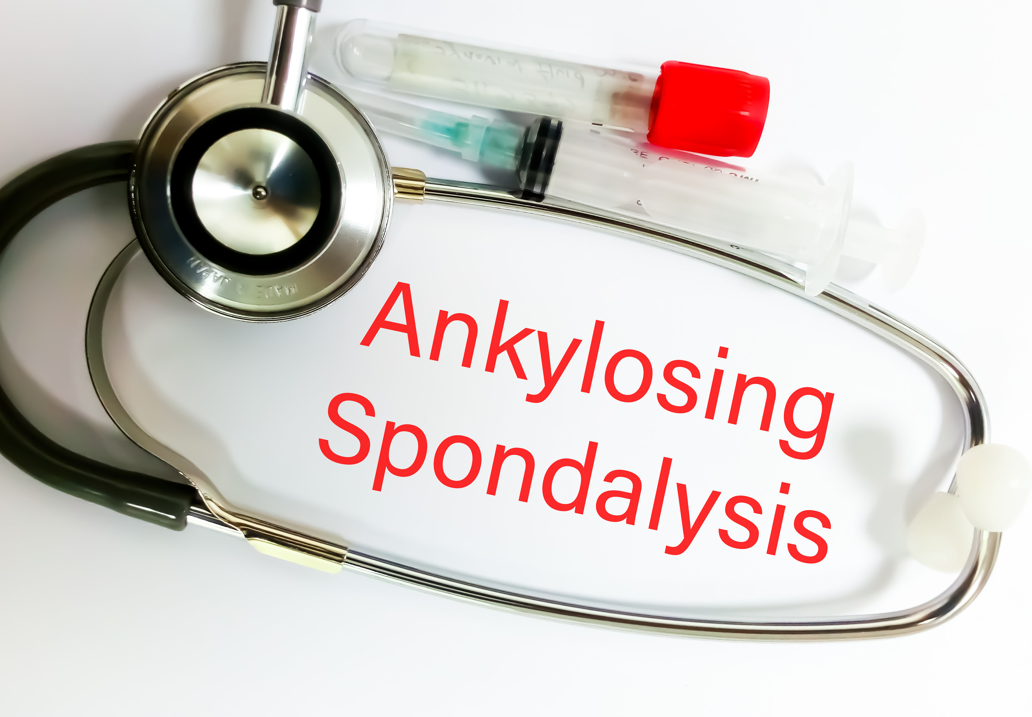 Анкилозирующий спондилит: что это, причины, симптомы и лечение