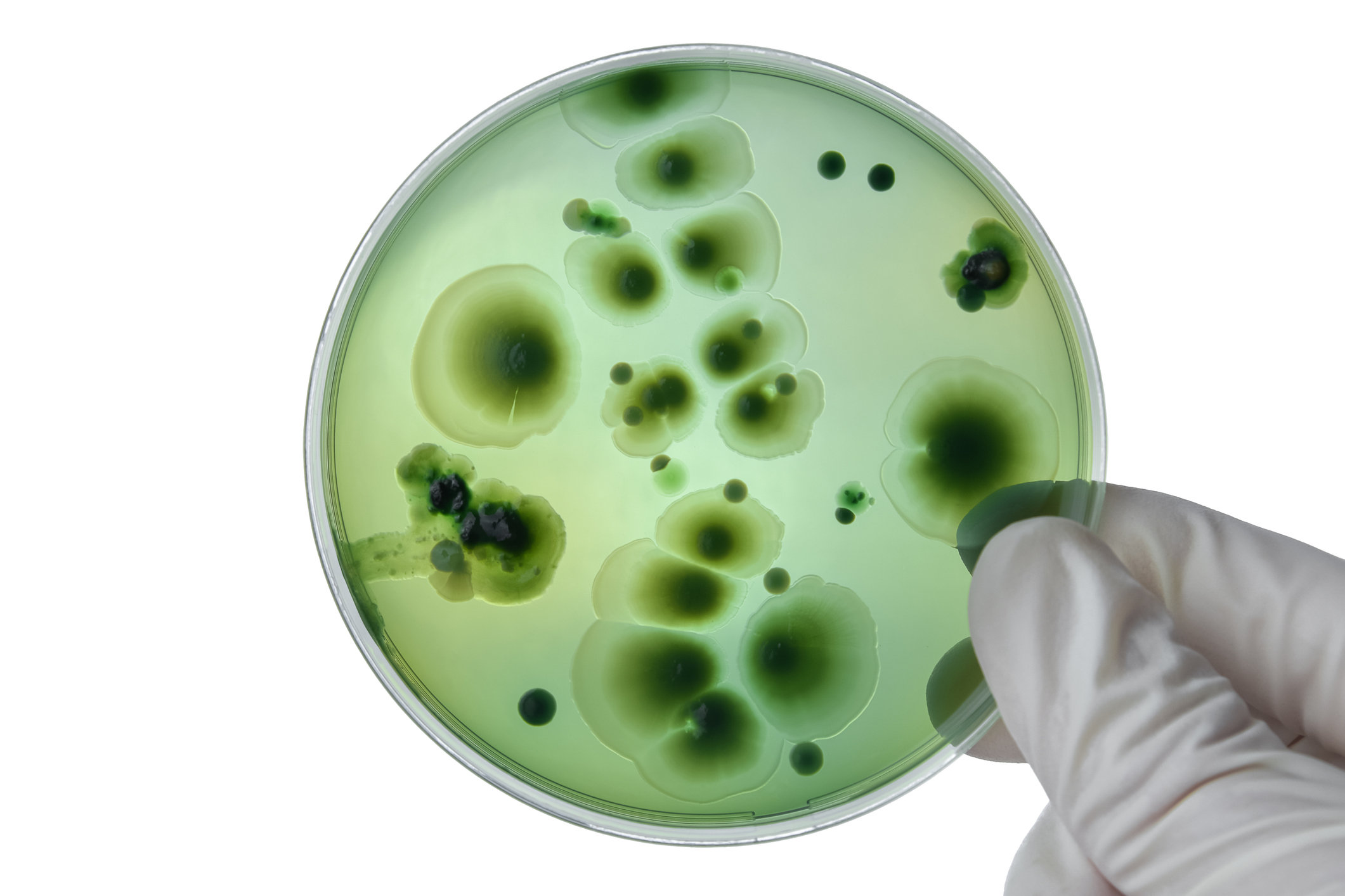 Грибок ног: что это такое, причины, симптомы, лечение