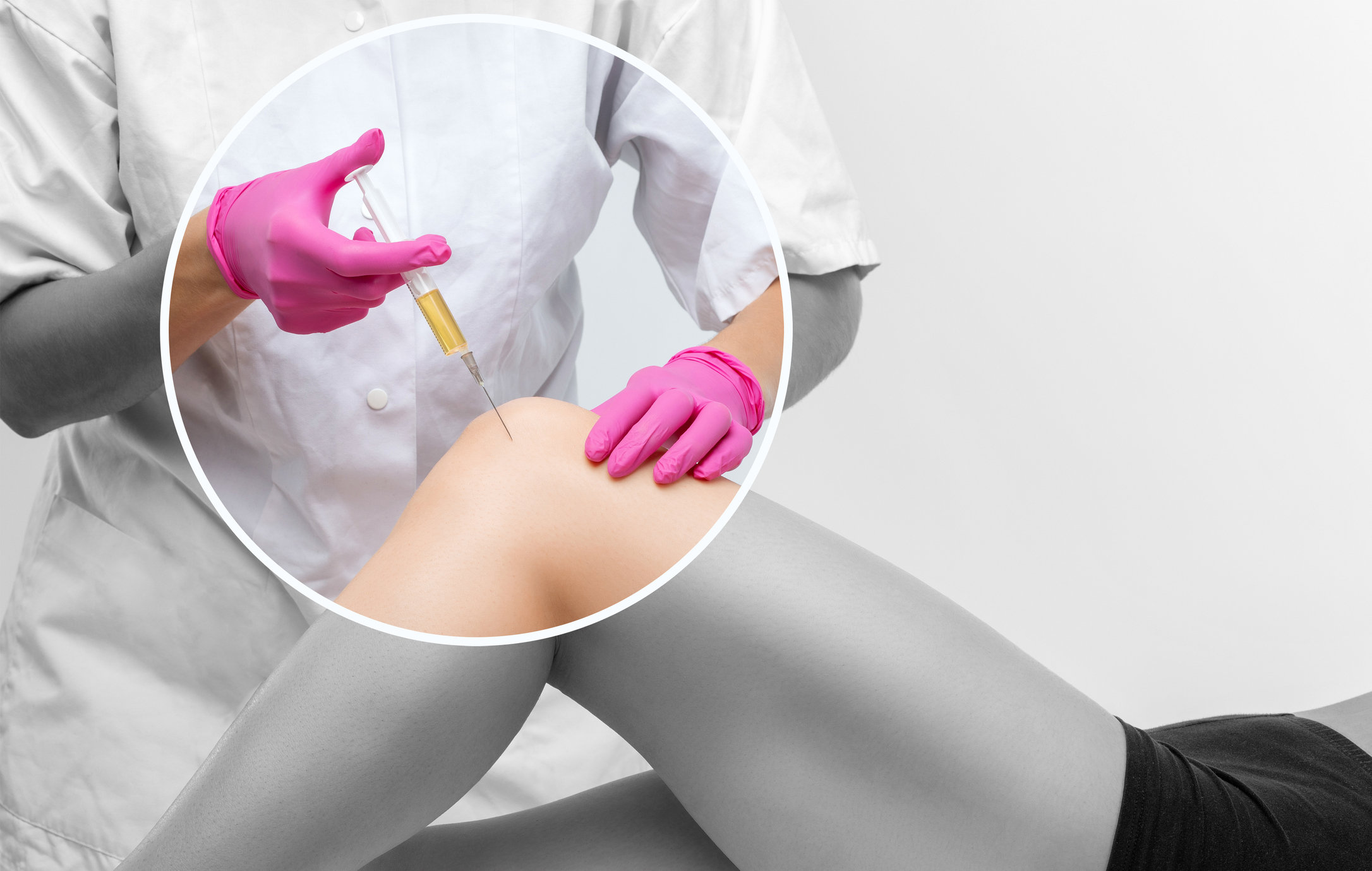 PRP инъекции при остеоартрите коленного сустава