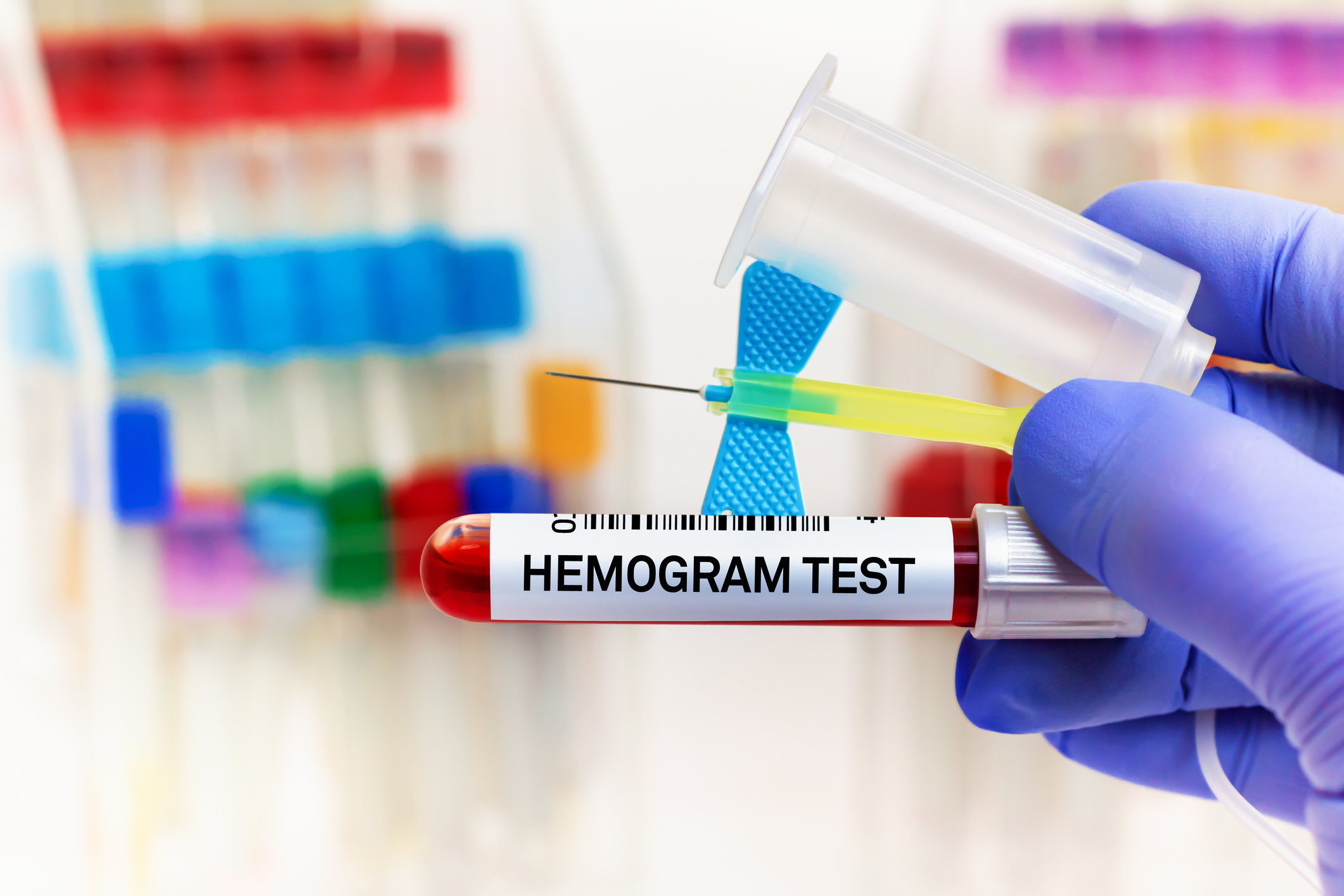 Что такое гематограмма (общий анализ крови)?