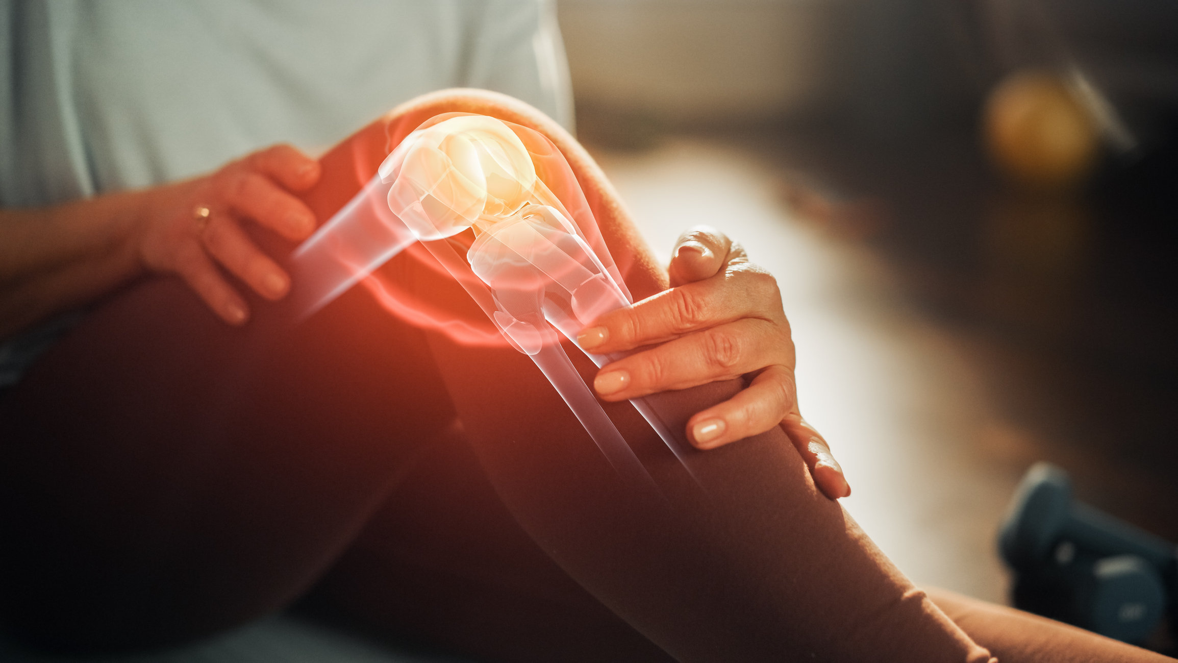 Что помогает при остеоартрите? Как лечить остеоартрит колена?