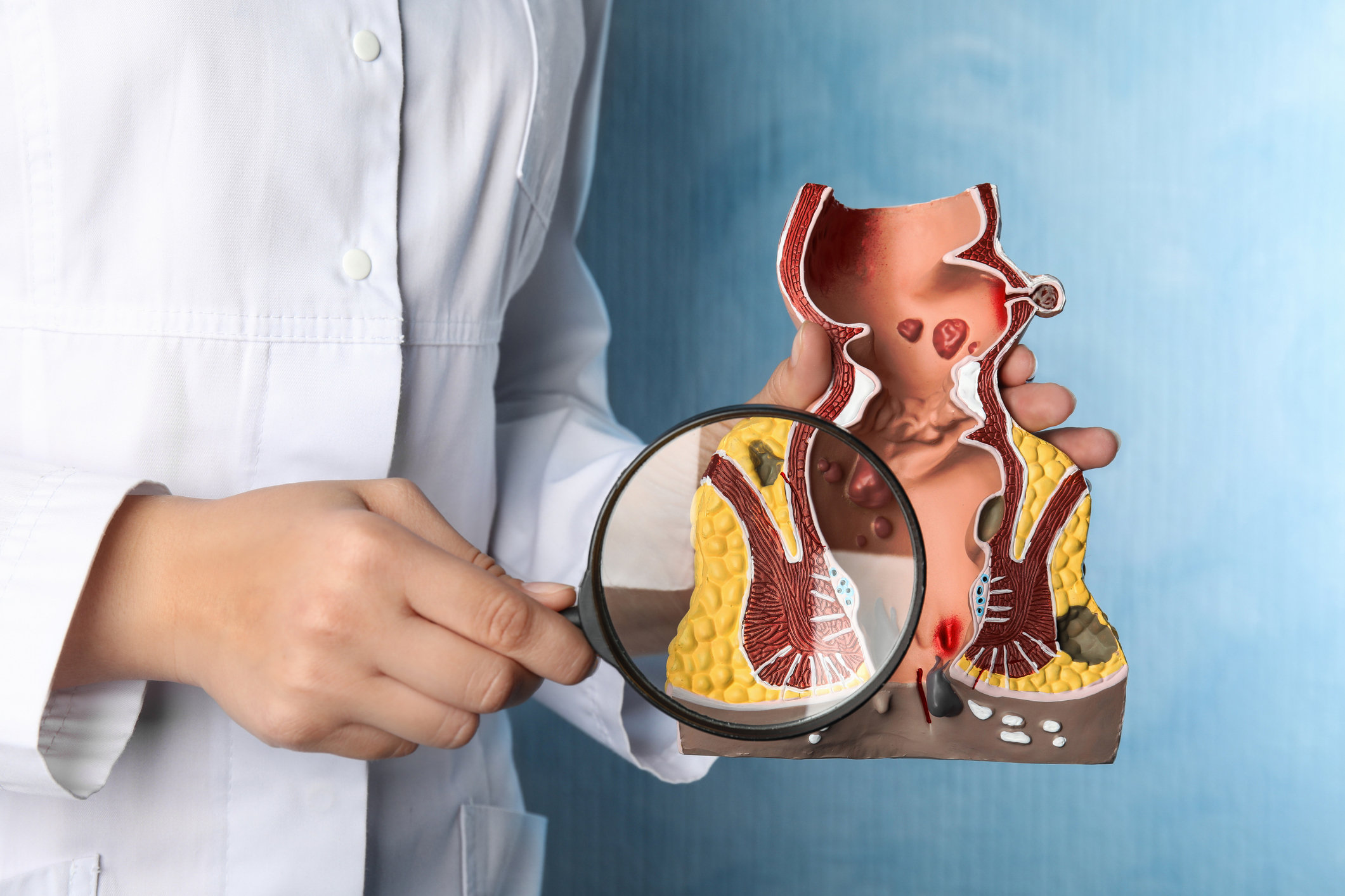 Почему возникает кровотечение из прямой кишки?