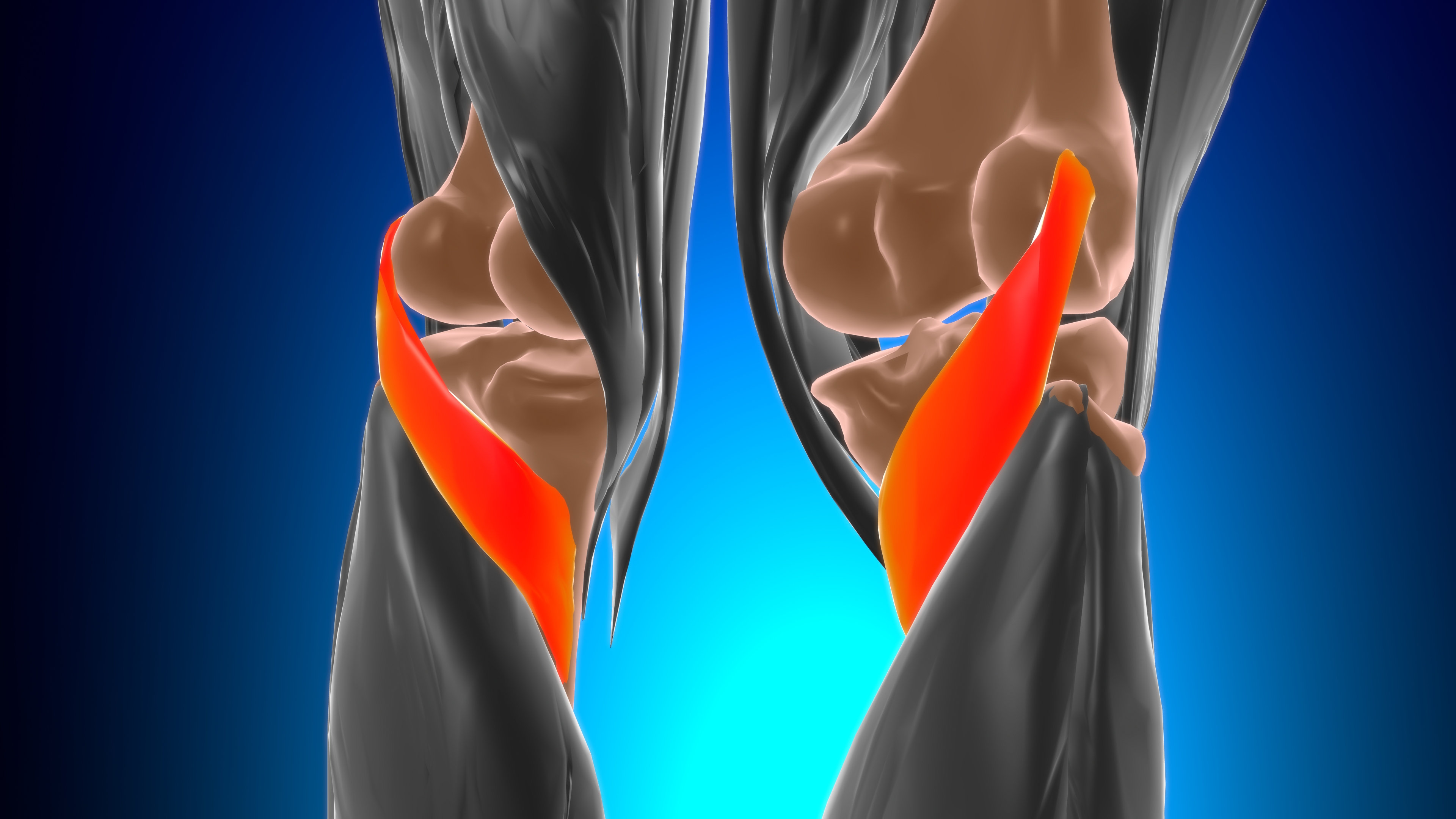 Что такое разрыв передней крестовидной связки, его симптомы и лечение?