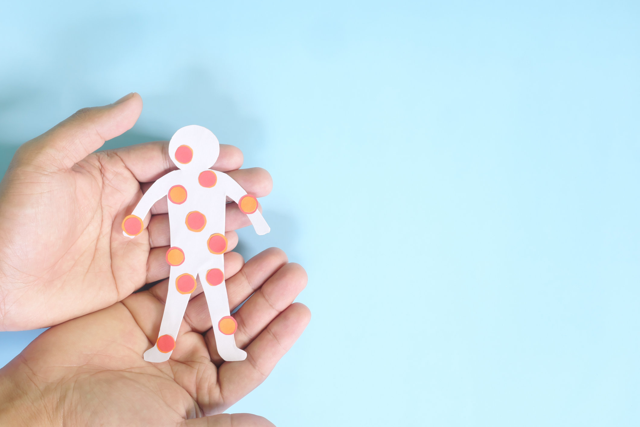 Ветряная оспа: Что это, Симптомы, Способности к Передаче и Лечение