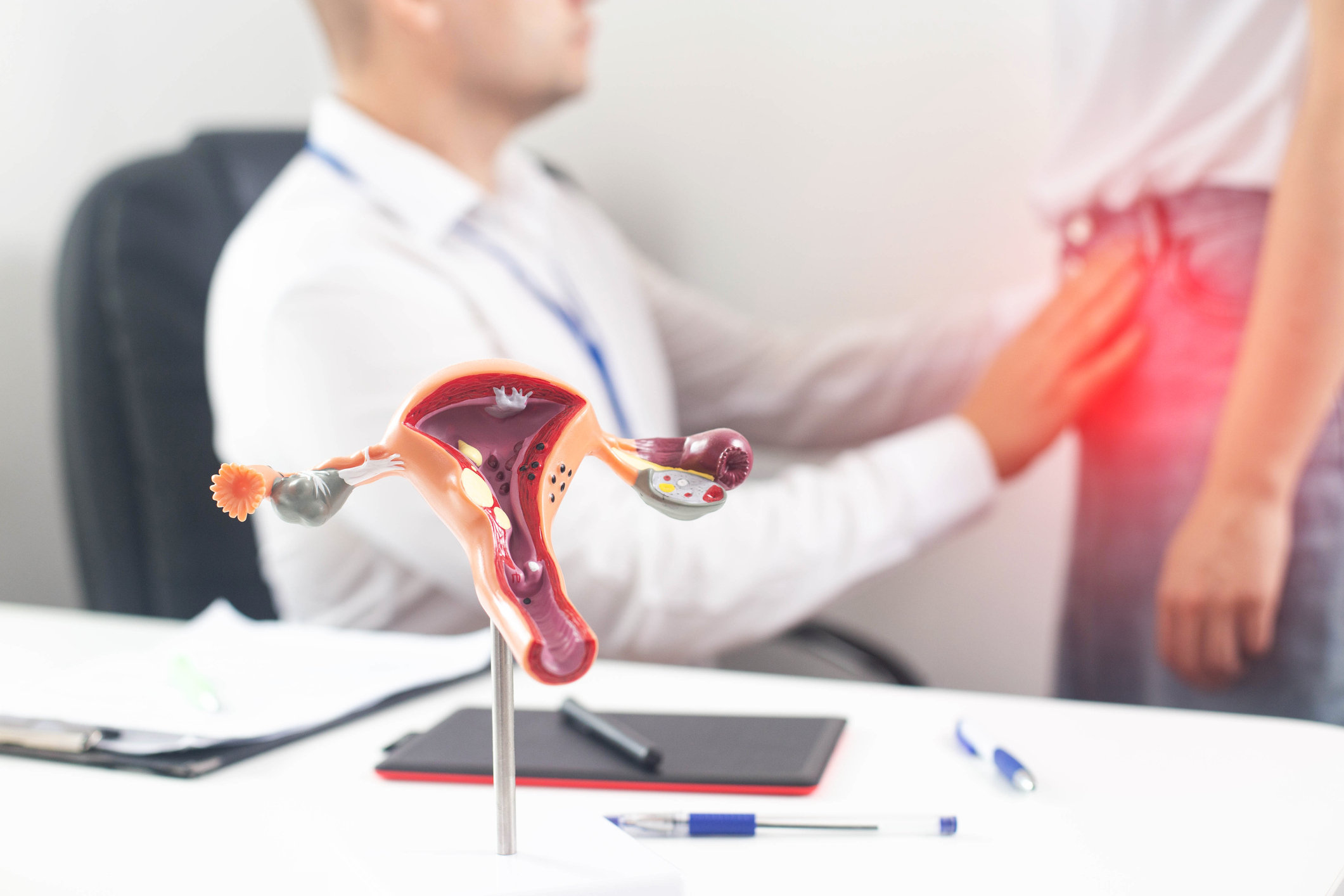 Что такое киста яичника?