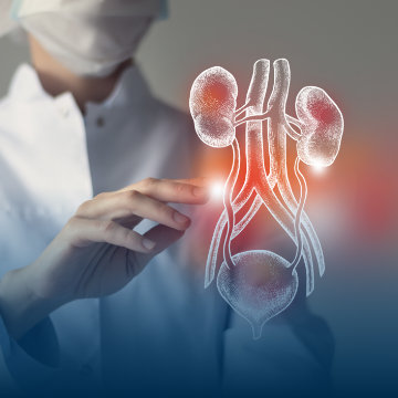 Центр урологической онкологии